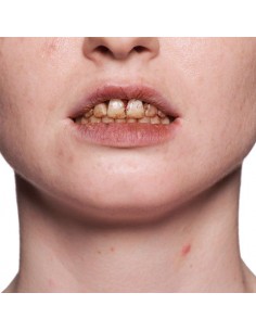 Smalto per Denti Kryolan (K1220) | Damas Italia